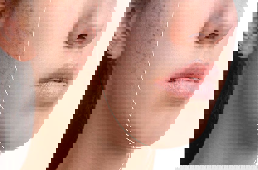 درمان لک و جوش 830